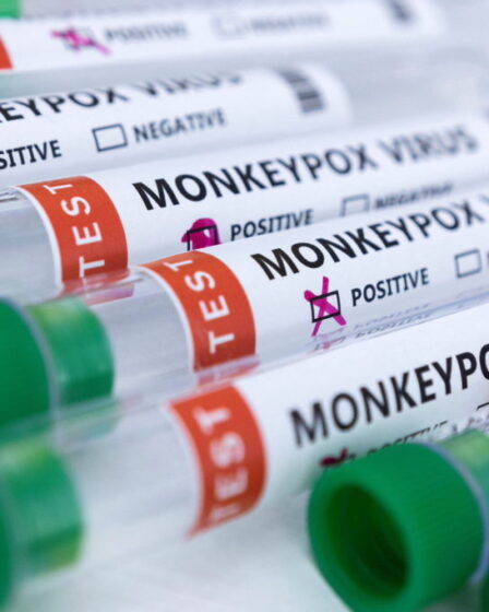 Monkeypox Test Kits