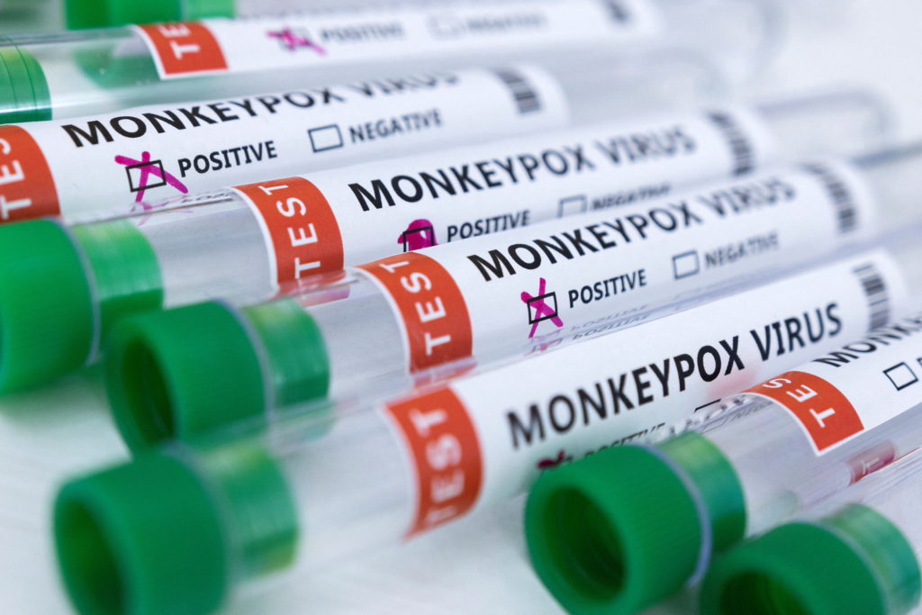 Monkeypox Test Kits