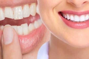 Cosmetic Dentistry