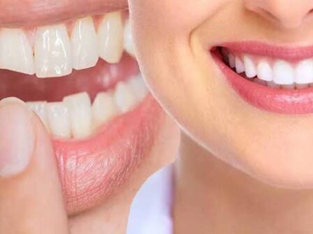 Cosmetic Dentistry
