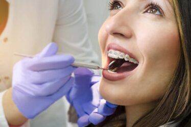 Orthodontic Services