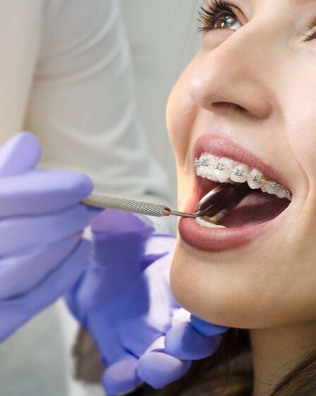 Orthodontic Services
